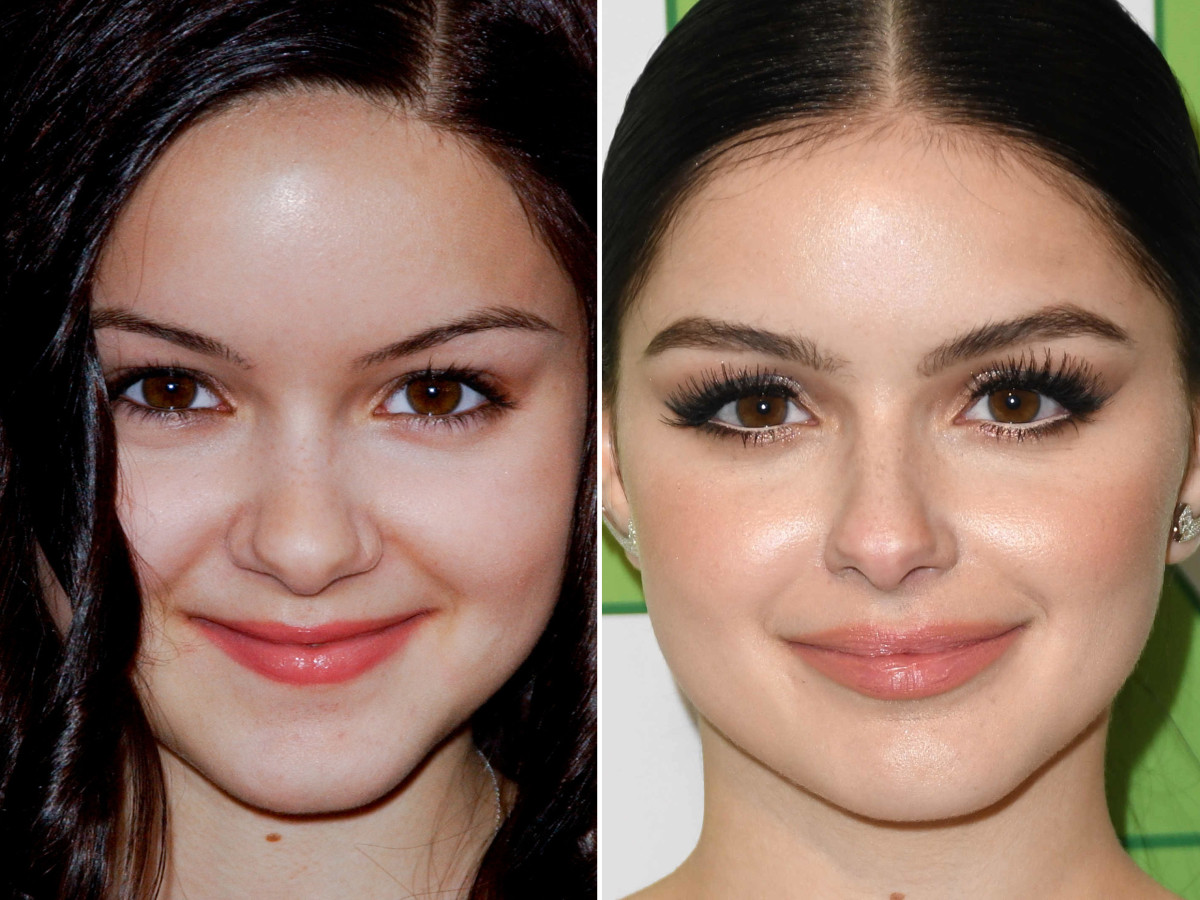 Ariel Winter Before And After Plastic Surgery Boob 